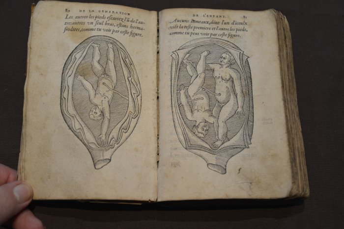Ambroise Paré - Deux livres de chirurgie - 1573