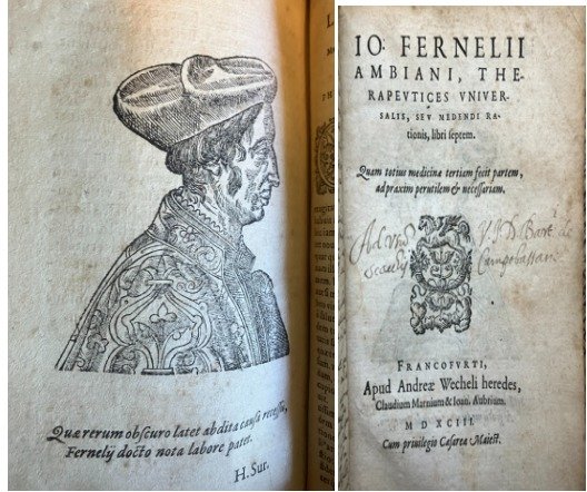 Jean-François Fernel - Therapeutices Universalis & De abditis rerum causis - 1593