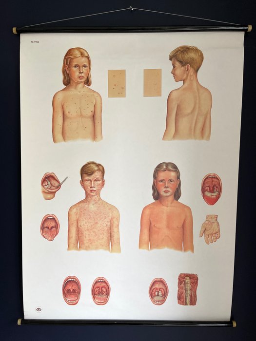 Deutsches Hygiene Museum Dresden - 教學用圖 - 9906 感染和兒童疾病 - PVC
