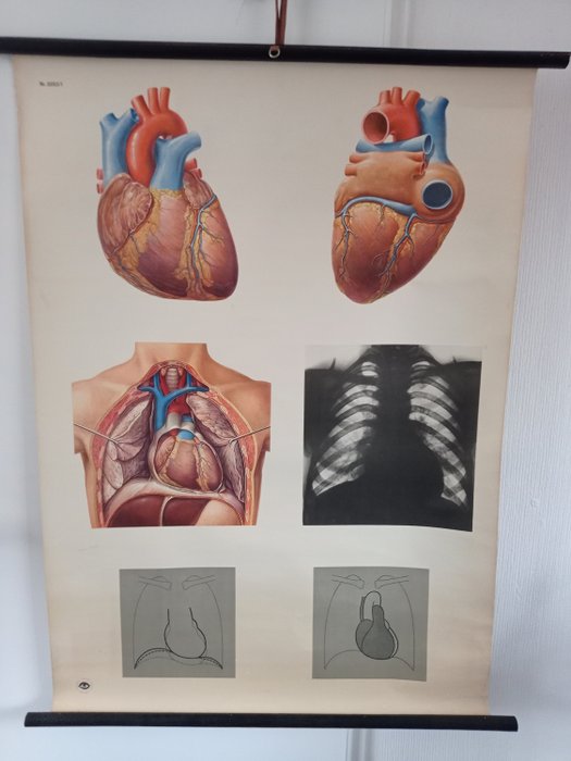 Deutsches Hygiëne Museum te Dresden - Mapa de escola - Doenças cardíacas. - Linho