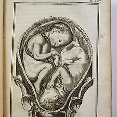 J.G. Roederer – Élemens de l’art des accouchemens. Augmentées des Observations sur les accouchemens laborieux – 1765