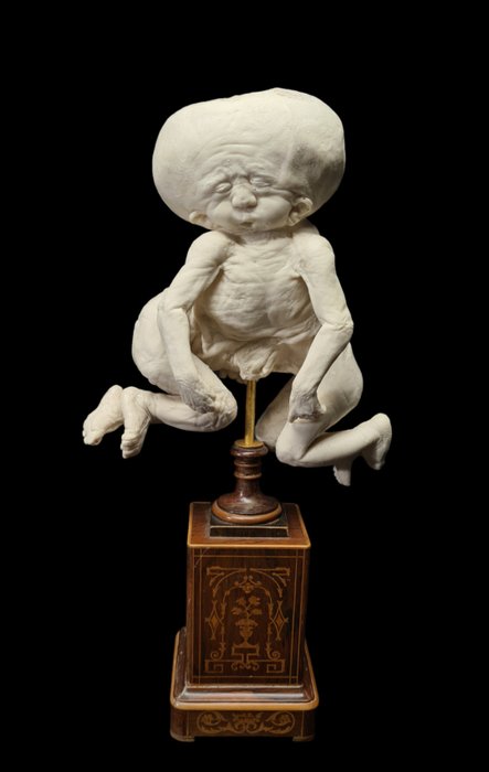 Original résine reproduction of real monster human 2 fetus - on antique wood stand  - Diorama - Frankreich