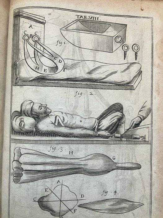 Wilhelm Fabry, Wilhelm Fabricius Hildanus, Fabricius von Hilden - Observations chirurgiques de Guillaume Fabri de Hilden - 1669